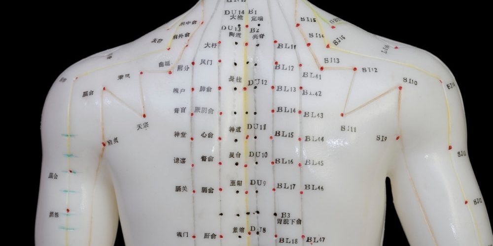 Understanding Acupuncture: A Comprehensive Overview